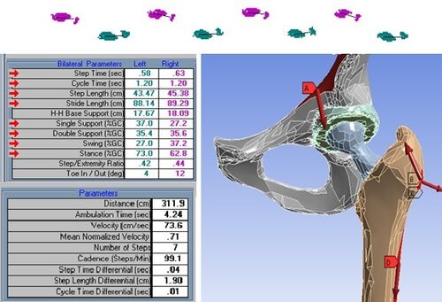 Biomechanics And Medical Engineering Solutions Reykjavik